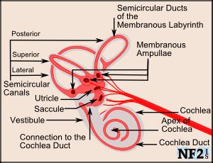 Bilateral Vestibular Hypofunction - Vestibularopothy