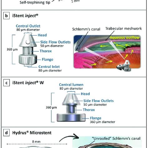 Ahmed implants. a-1 The Ahmed ® Glaucoma Valve showing its components ...