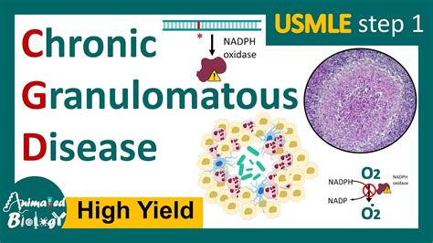 Chronic Granulomatous Disease Cgd Nadph Oxidase Mutation