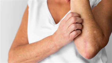 Skin Rashes Symptoms Causes And 9 Ayurvedic Remedies To Treat Them