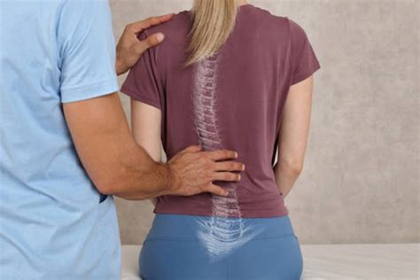 Mississauga Chiropractor For Better Posture The Health First Group Blog