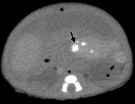 Airp Best Cases In Radiologic Pathologic Correlation Prenatal And Postmortem Imaging Of A