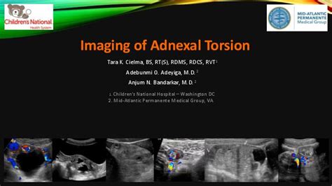 Imaging Features of Adnexal Torsion SPR Poster Archive