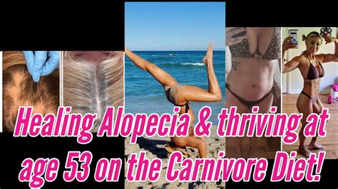 Carnivore Diet Success At Age 53 Healing Alopecia Thriving Through