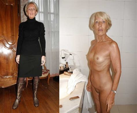 Before After Dressed Undressed 31d 79 Porn Pic Eporner