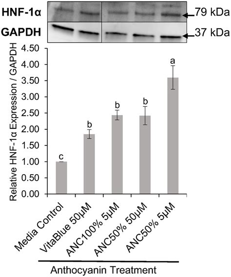 Effects Of Anthocyanin Extracts On Nuclear Hepatocyte Nuclear Factor