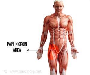 Groin Pain - Symptom Evaluation - References