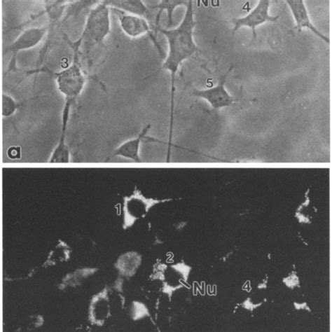 Phase Contrast A And Immunofluorescent B Microscopic Photographs Of