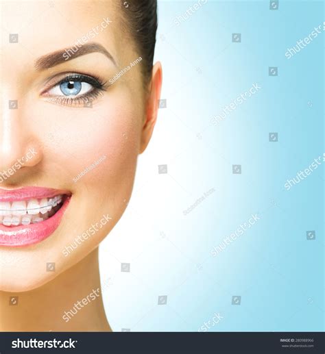 Braces Beautiful Woman Smile Close Up Stock Photo 280988966 - Shutterstock