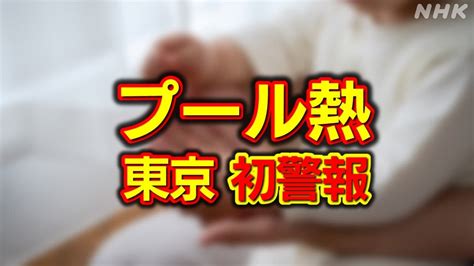 東京都 プール熱の感染者増加で初の警報発表 インフルもほぼ横ばい～病児保育施設は予約取りにくい～ Nhk