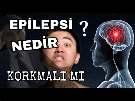 EPİLEPSİ NEDİR SARA KRİZİ NEDEN OLUR EPİLEPSİ NÖBETİ NASIL ÖNLENİR