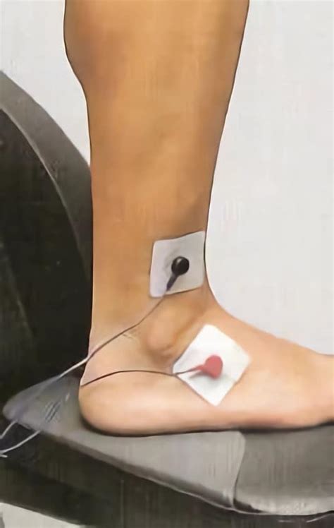 Guía Para La Colocación De Electrodos En Fisioterapia