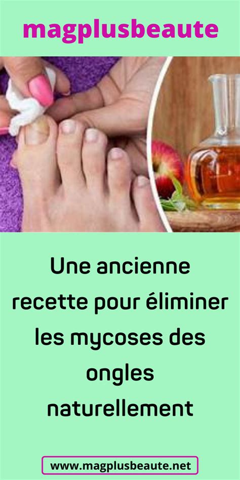 Une Ancienne Recette Pour Liminer Les Mycoses Des Ongles Naturellement