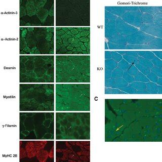 KO muscles showed increased expression of Z-disk proteins in fast ...