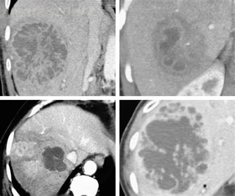 CT Quick Guides - CTisus.com CT Scanning