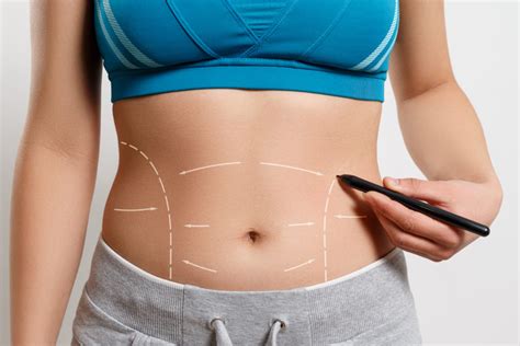 Abdominoplasty In Turkey Tummy Tuck In Turkey