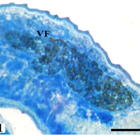 Schematic diagram of four consecutive stages of vitellogenesis in ...