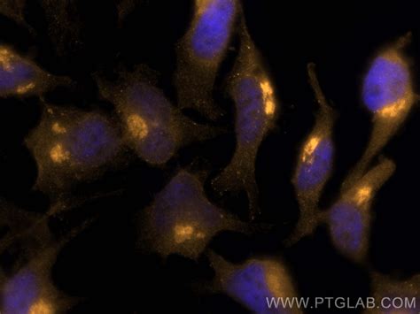 Clusterin Antibody Cl555 12289 Proteintech