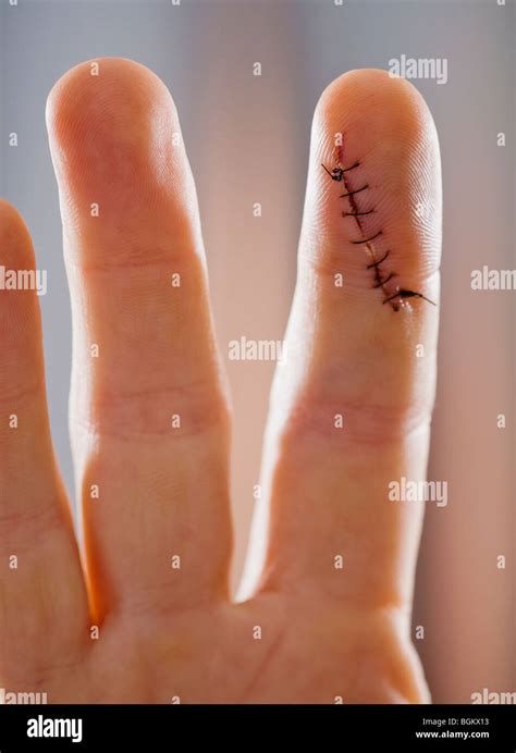 Stitches cut hi-res stock photography and images - Alamy