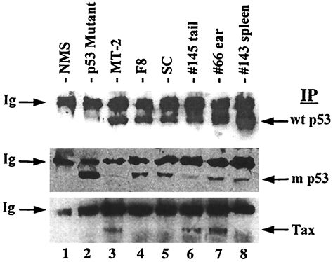 Analysis Of P53 Inactivation In A Human T Cell Leukemia Virus Type 1