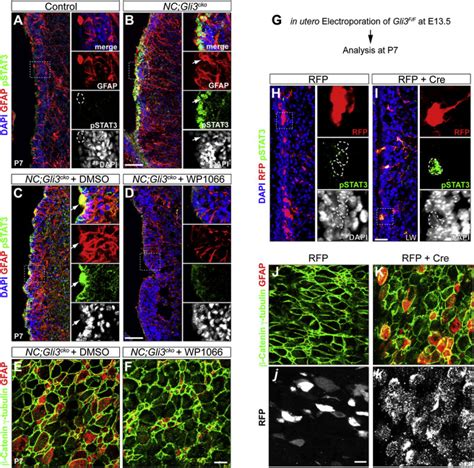 Gli Repressor Controls Cell Fates And Cell Adhesion For Proper