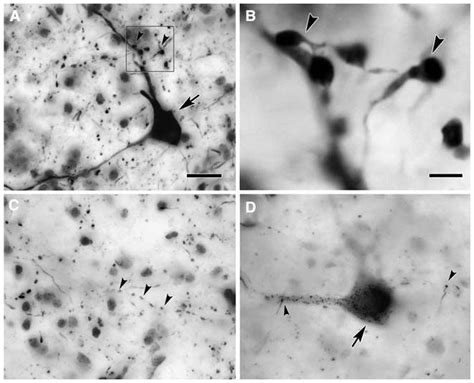 Photomicrographs Of Bda Labeled Terminals And Retrogradely Labeled