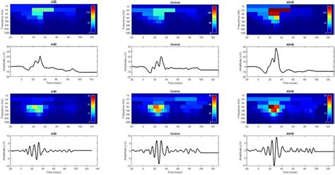 Frontiers Discrete Wavelet Transform Analysis Of The