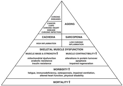 Muscle Wasting Disease (MWD) in Cachexia and Sarcopenia - SCWD