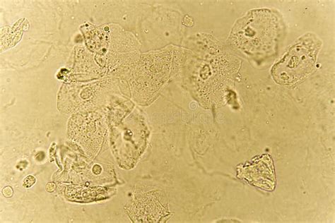 Types Of Epithelial Cells In Urine