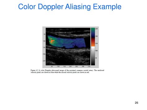 Ppt Vessel Recognition In Color Doppler Ultrasound Imaging Powerpoint Presentation Id 9411129