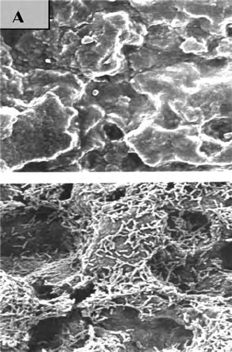 Candida albicans biofilm development: 1) conditioning film formation on ...