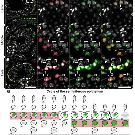 Preleptotene Leptotene Zygotene And Early Pachytene Spermatocytes