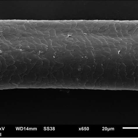 Scanning electron microscopy. High magnification showing a channel in ...