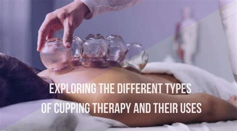 Exploring the Different Types of Cupping Therapy and Their Uses ...