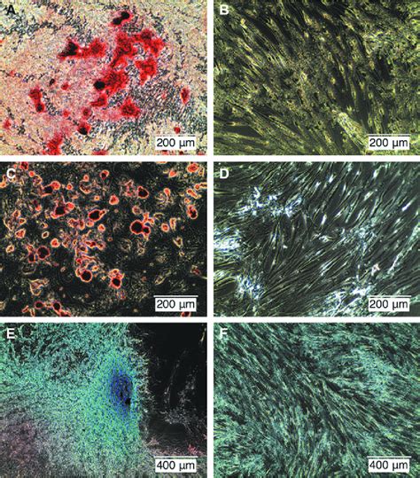 Mesenchymal Stem Cells Osteogenic A Adipogenic C And Chondrogenic