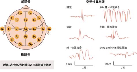 診断・検査 | UCBCares Japan