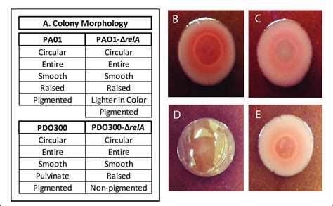 Colony Morphology A Chart Describing The Colony Morphologies In The