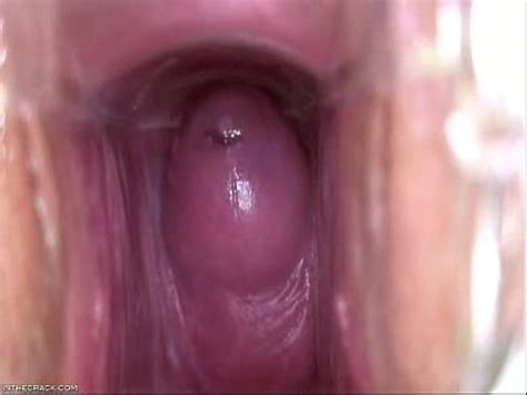 Take A Look Inside XVIDEOS