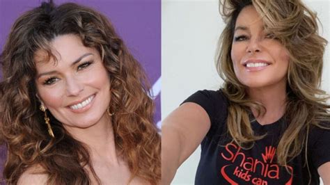 Shania Twains Plastic Surgery With Then And Now Pictures Heres All