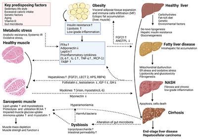 Frontiers Impact Of Sarcopenia On The Severity Of The Liver Damage In