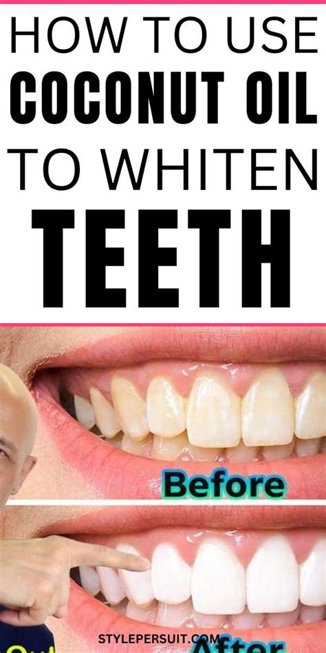 How To Whiten Teeth With Coconut Oil Fast And Easily Coconut Oil For