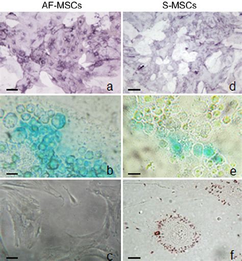 Differentiation Potential Of Af Mscs And S Mscs Towards The Osteogenic