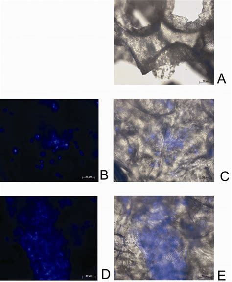 Human Nucleus Pulposus Like Cells Were Seeded Onto Pu Spheroids The