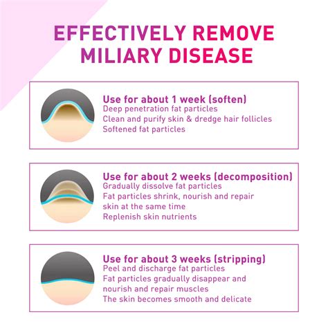 Milia Treatment Cream-1149