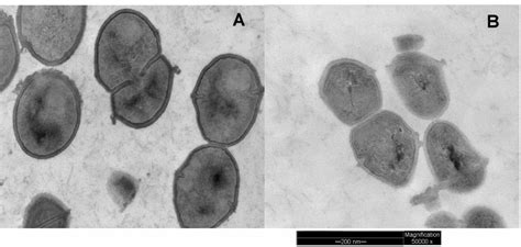 Strep Throat Virus Microscopic