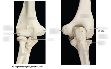 Elbow joint Diagram | Quizlet