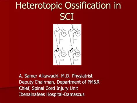 Ppt Heterotopic Ossification In Sci Powerpoint Presentation Free Download Id 907865