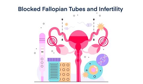 7 Steps To Getting Pregnant With Blocked Fallopian Tubes