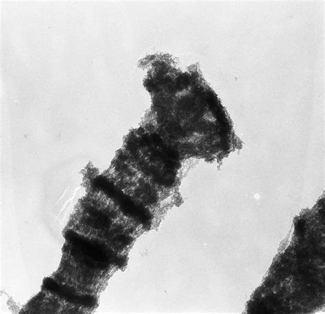 Drosophila Melanogaster Polytene Chromosome Cil Doccheck