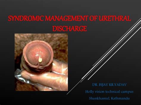 21 Syndromic Management Of Urethral Discharge